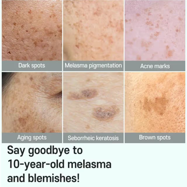 Carenel Anti Melasma Cica Intensive Serum