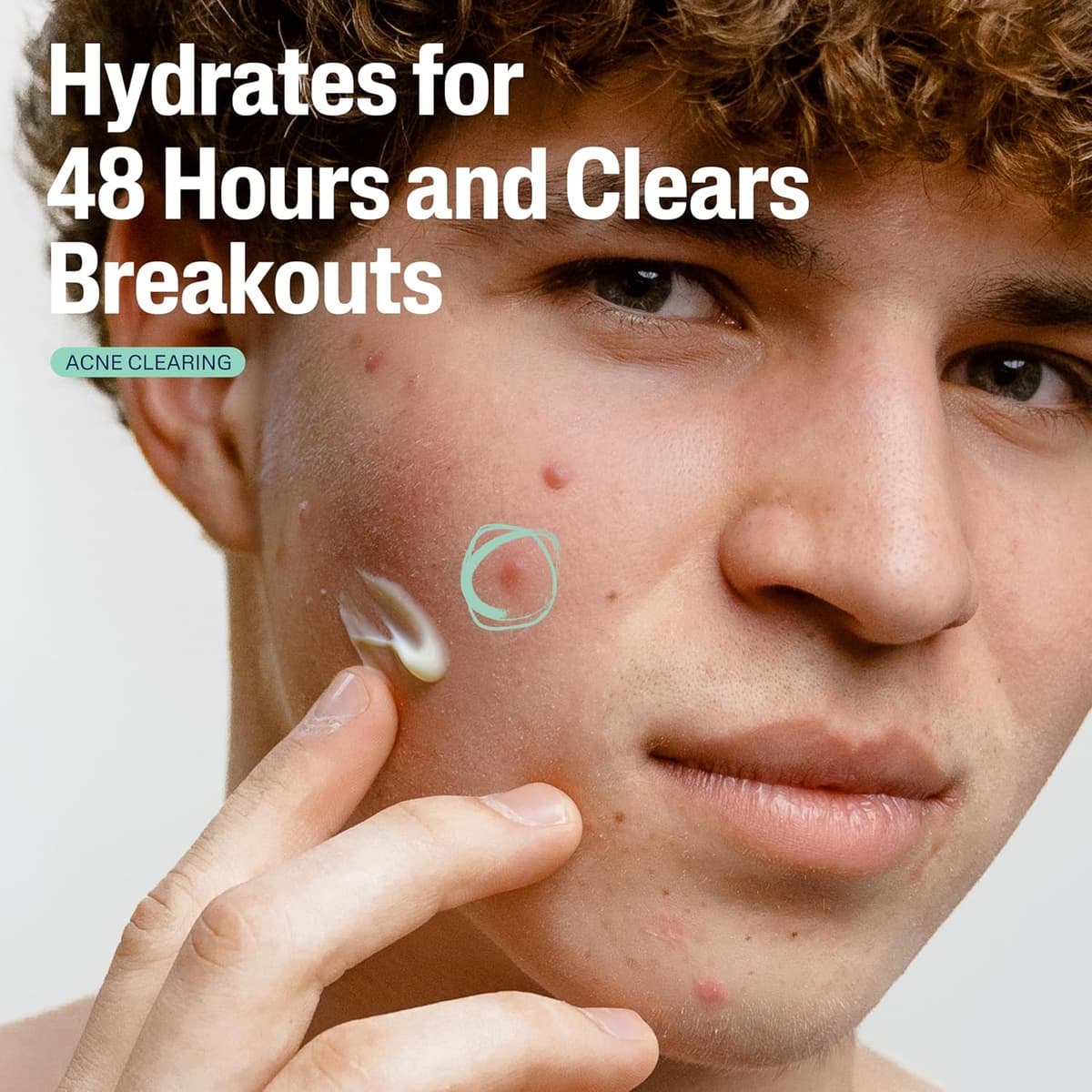 Cetaphil Mattifying Acne Moisturizer