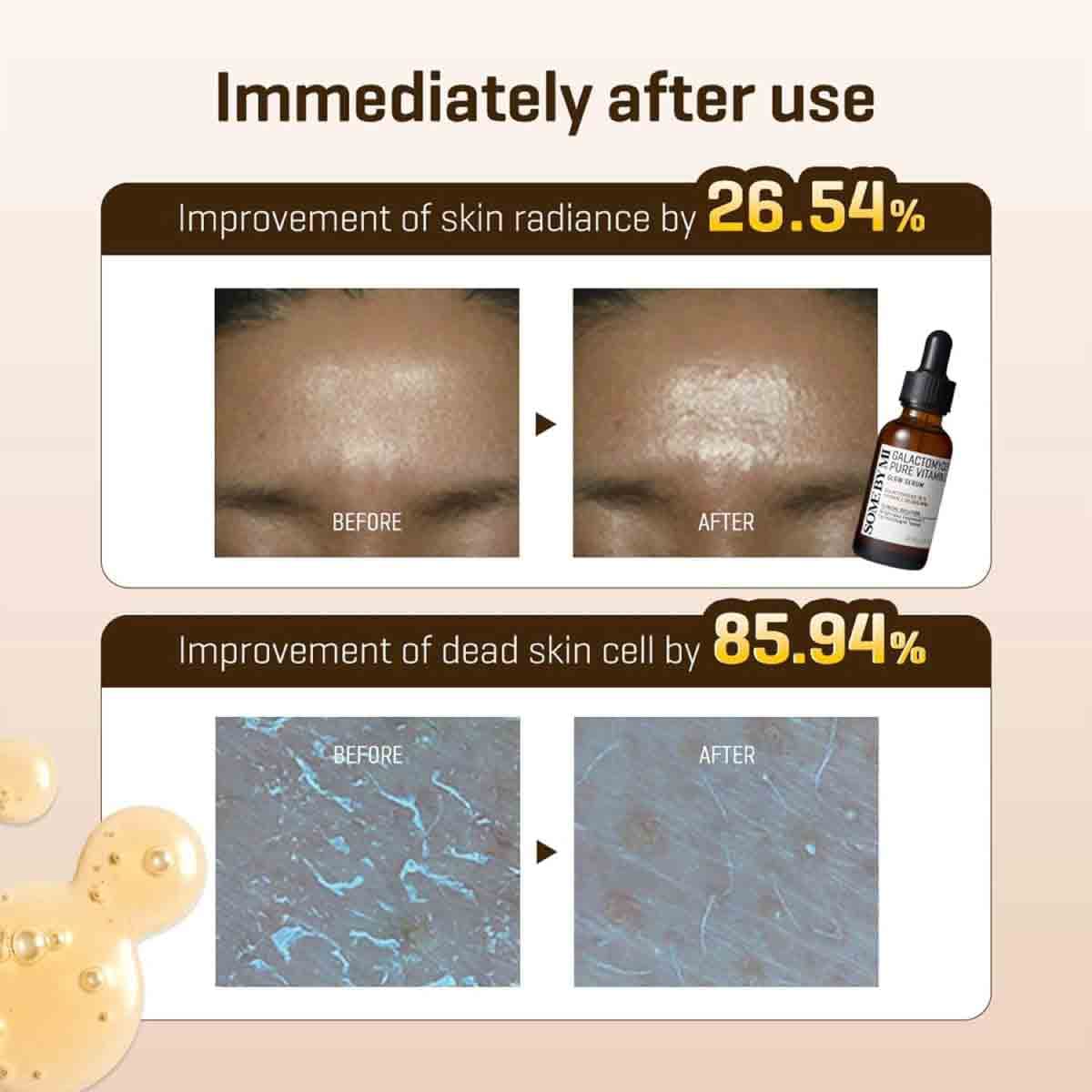 SOME BY MI Galactomyces Pure Vitamin C Glow Serum