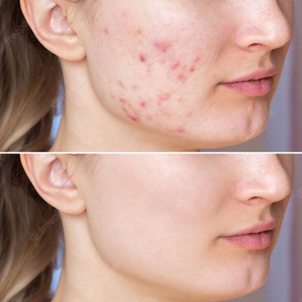 Care Nel Anti Melasma Cica Treatment Toner