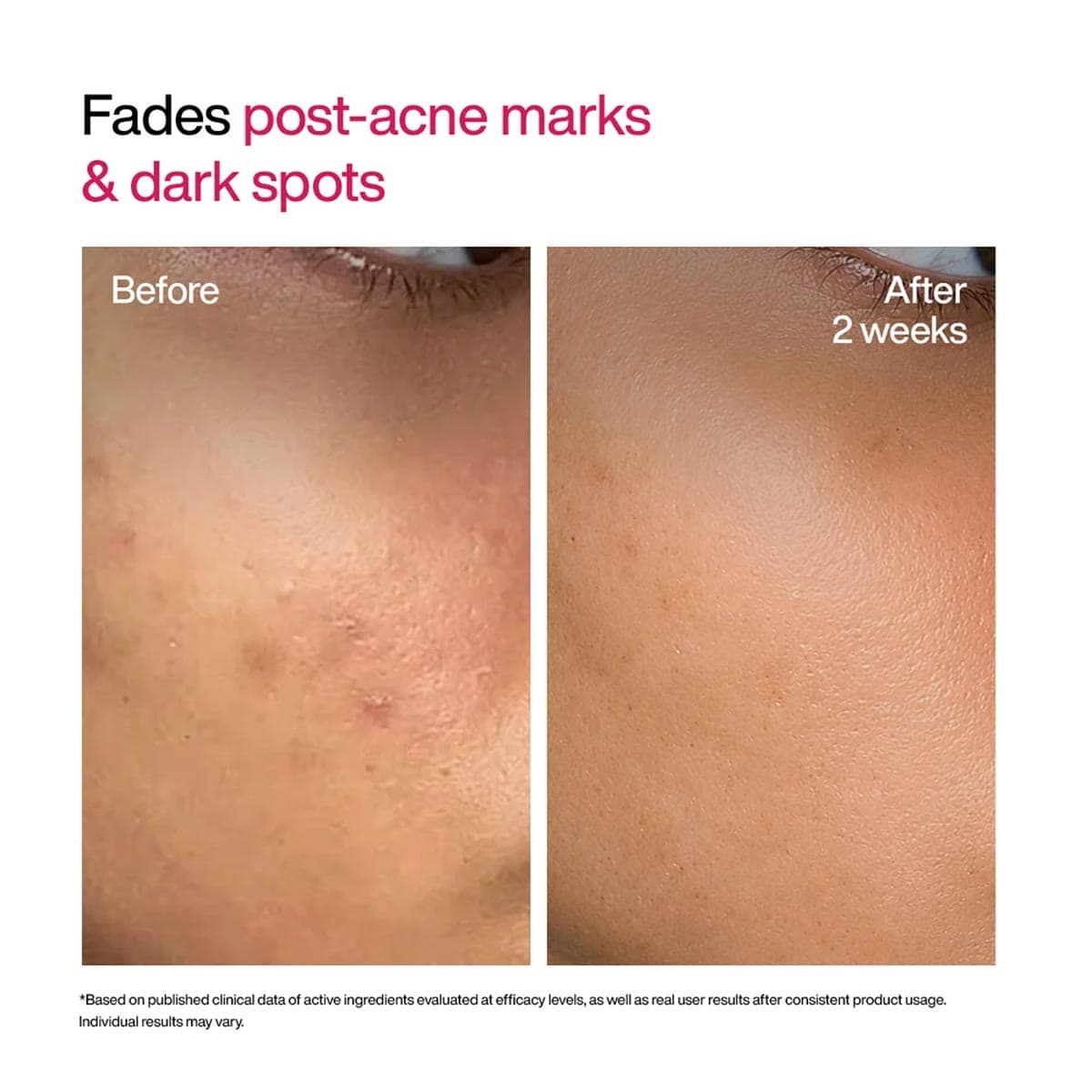 Wishcare Advanced Dark Spot Correcting TXA Shot