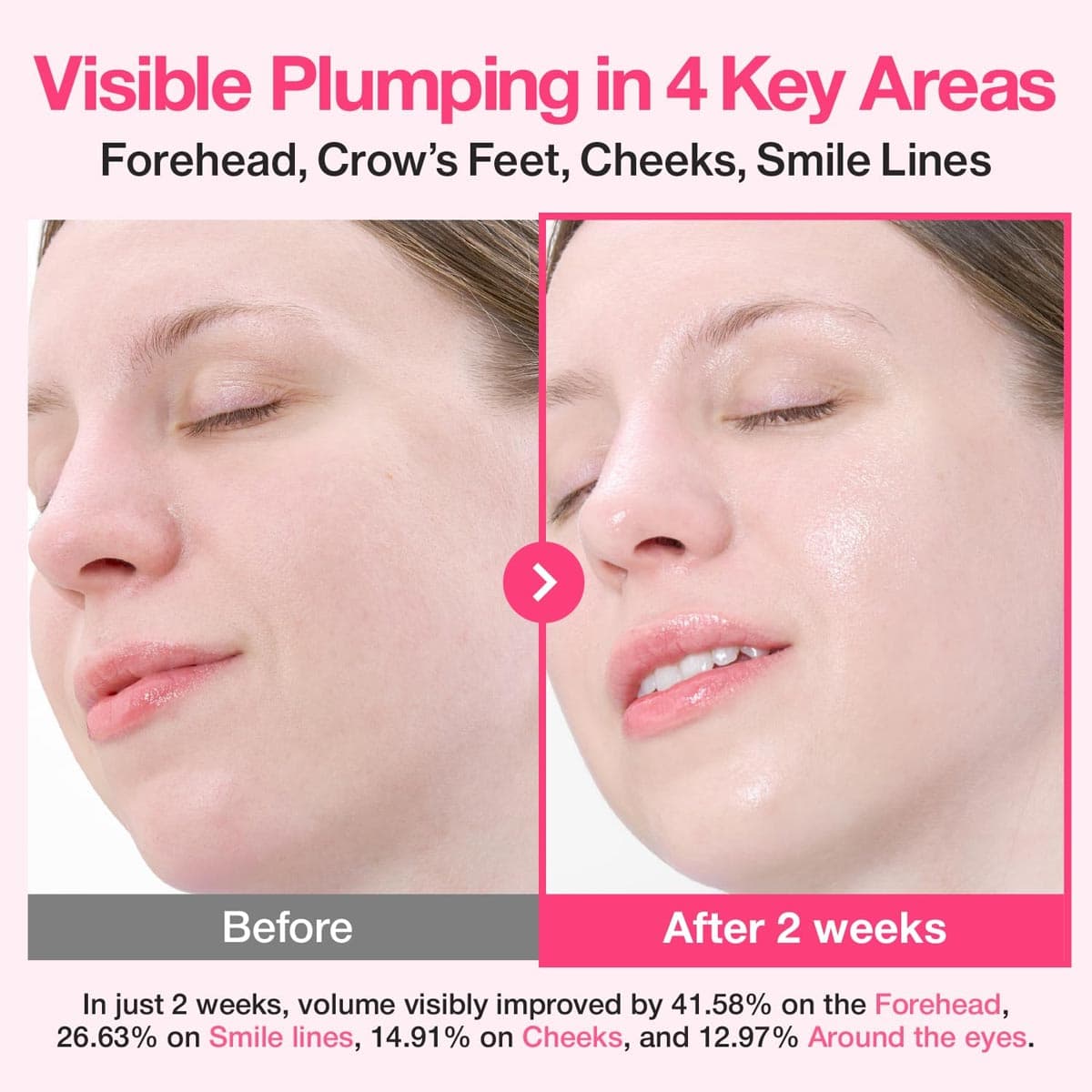 Numbuzin Rose PDRN Collagen Plumping Serum