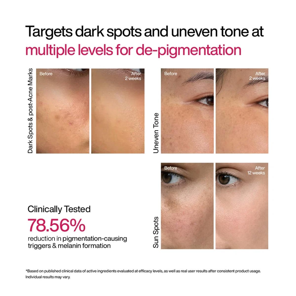 Wishcare Advanced Dark Spot Correcting TXA Shot