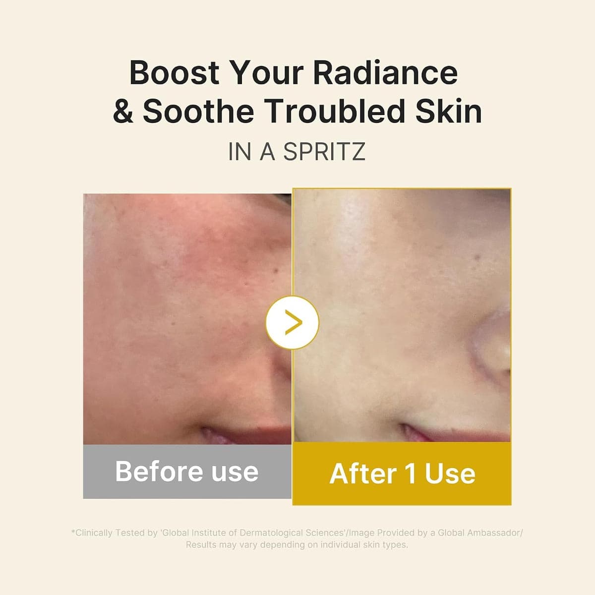 Medicube Kojic Acid Turmeric Vita Jelly Mist Serum