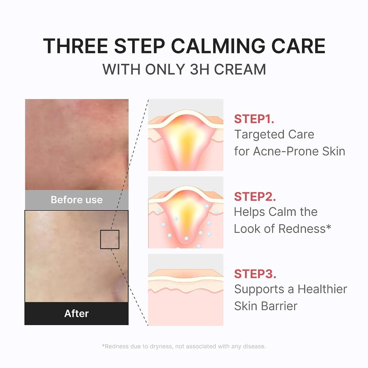 Medicube 3H Relief Cream