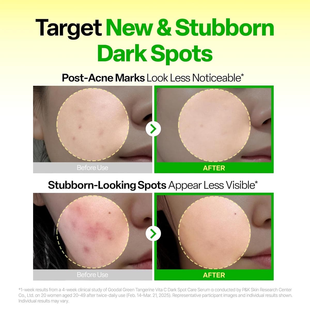 Goodal Vita-C Dark Spot Care Serum