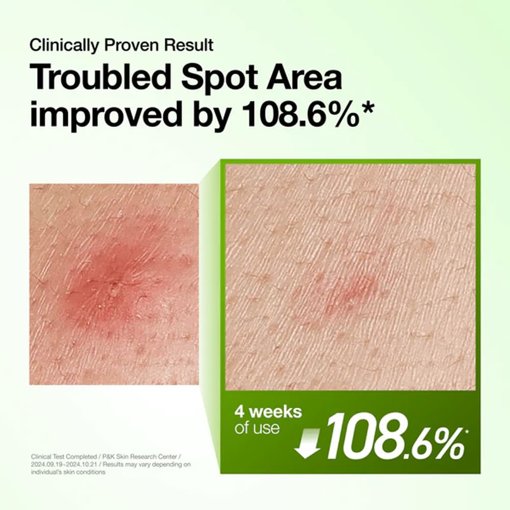 Anua Azelaic Acid 10+ Hyaluron Redness Soothing Serum