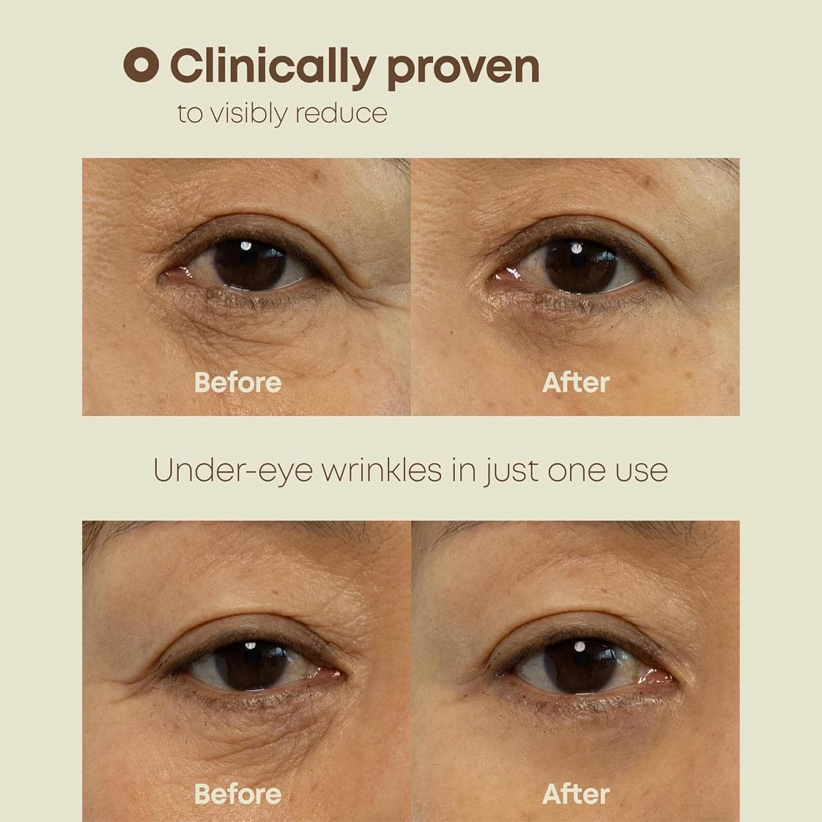 Nineless Ever-Youth Dual Effect Eye Cream