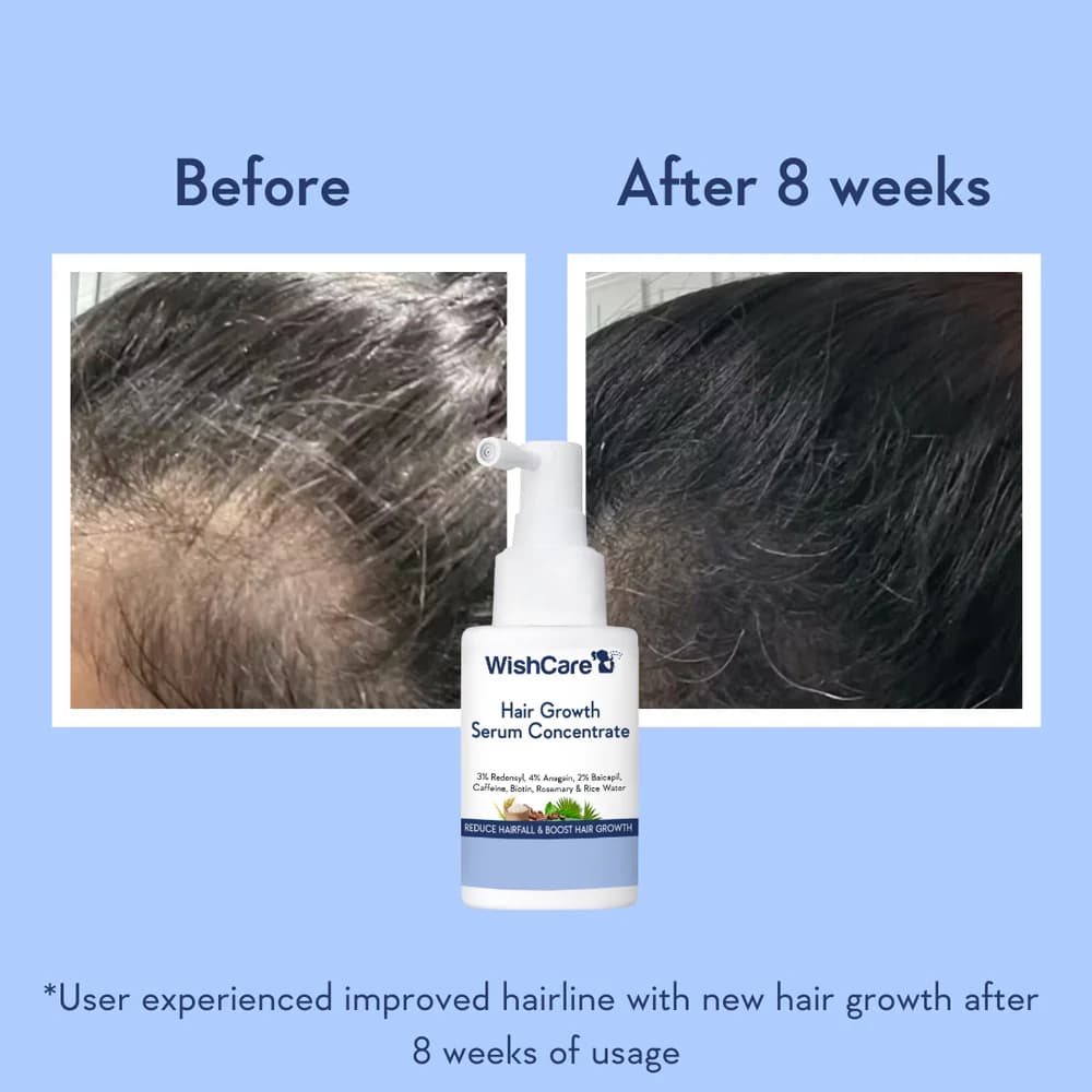Wishcare Hair Growth Serum Concentrate