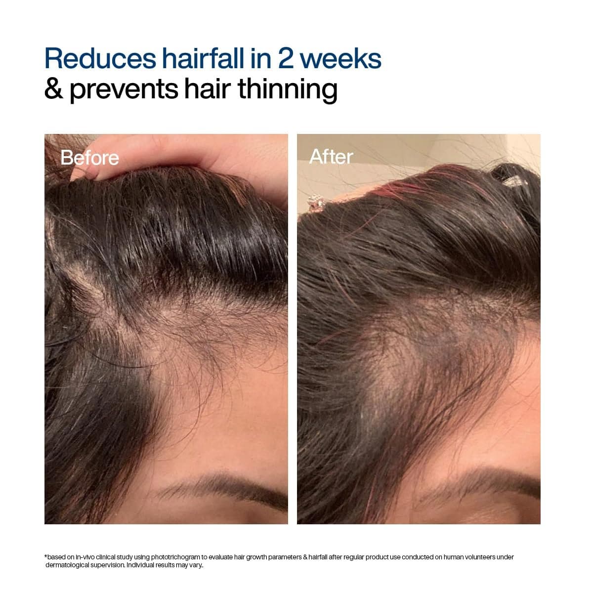Wishcare Hair Growth Serum Concentrate Roll-on
