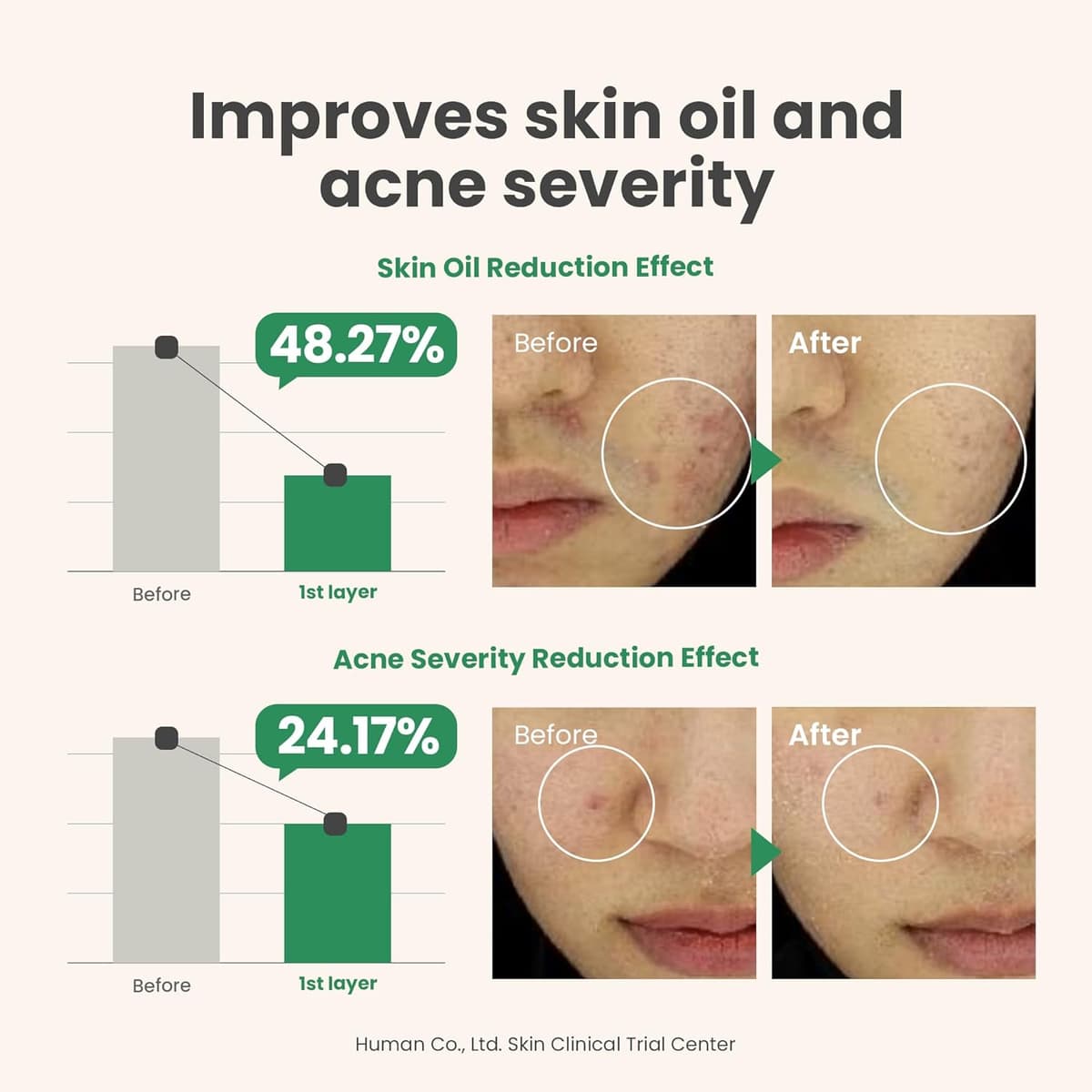 Axis Y Spot The Difference Blemish Treatment