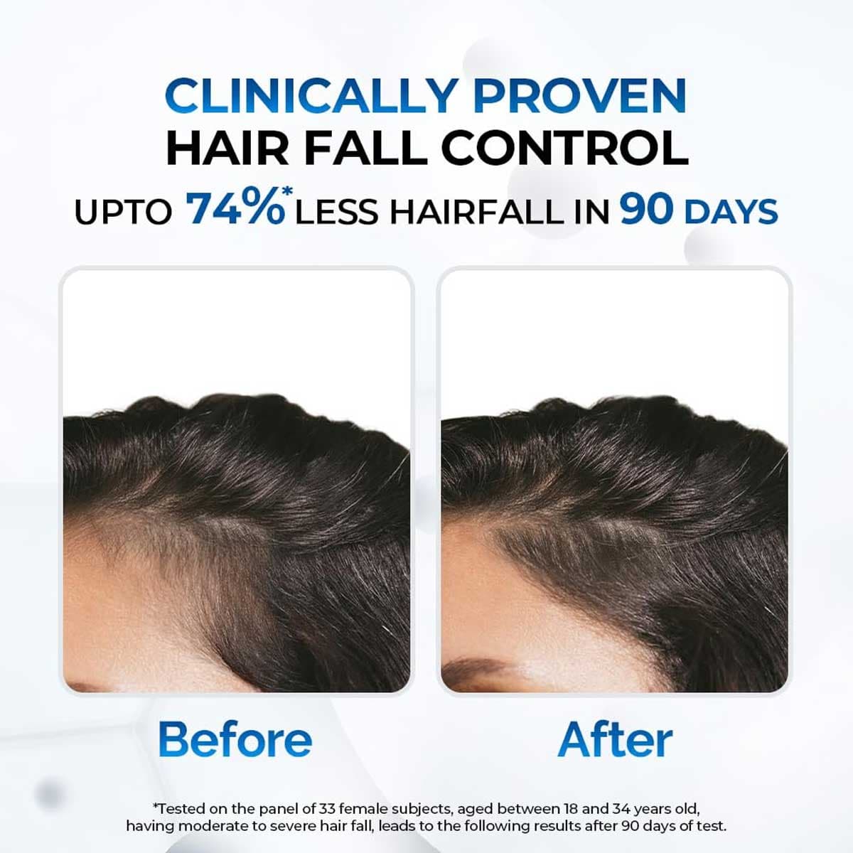 Streax Scalp Care Anti-Hairfall Masque
