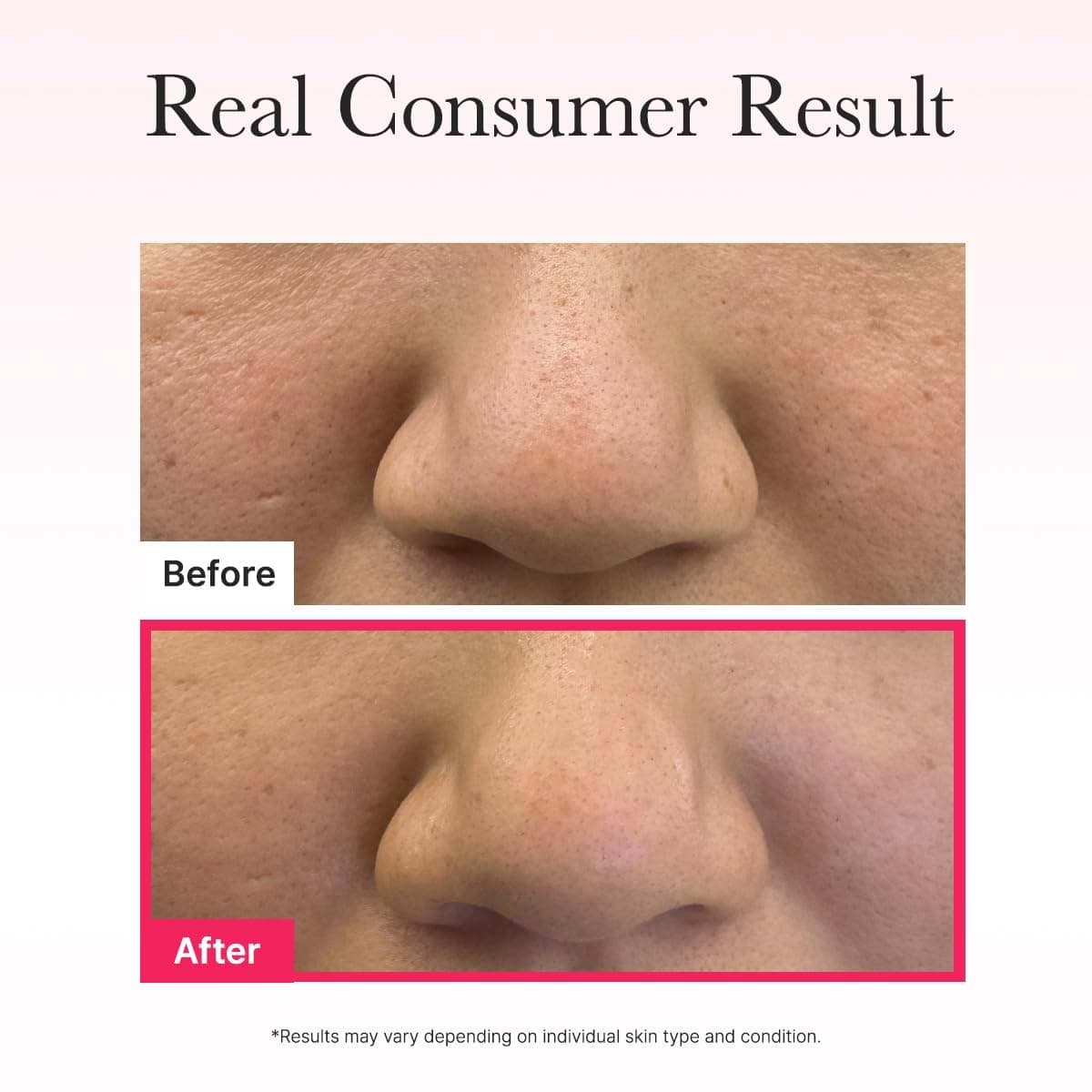 Arencia Red Collagen Jello Mask (1 Pcs Mask)
