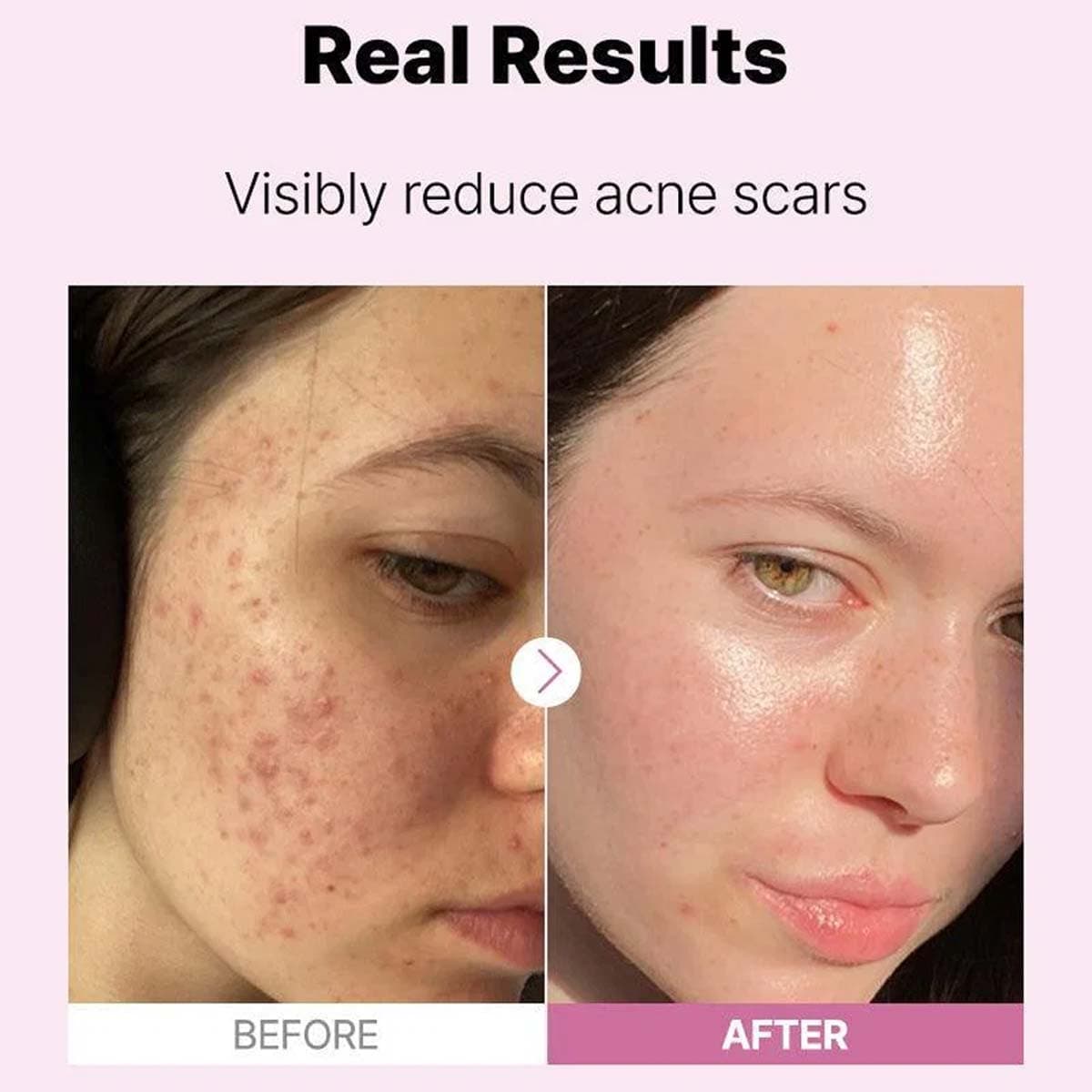 Cosrx The Niacinamide 15 Serum