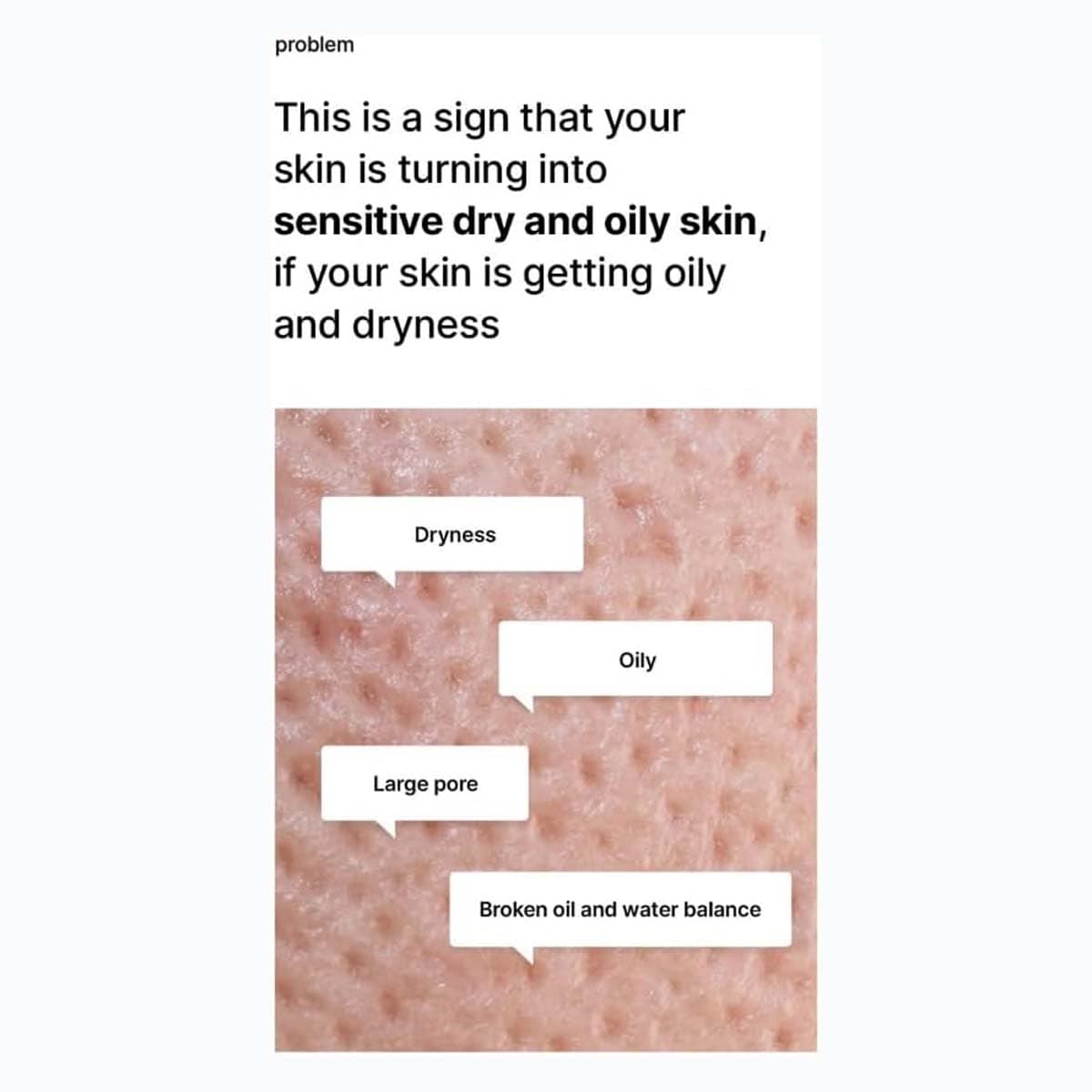 Celimax Oil Control Moisturizing Cream