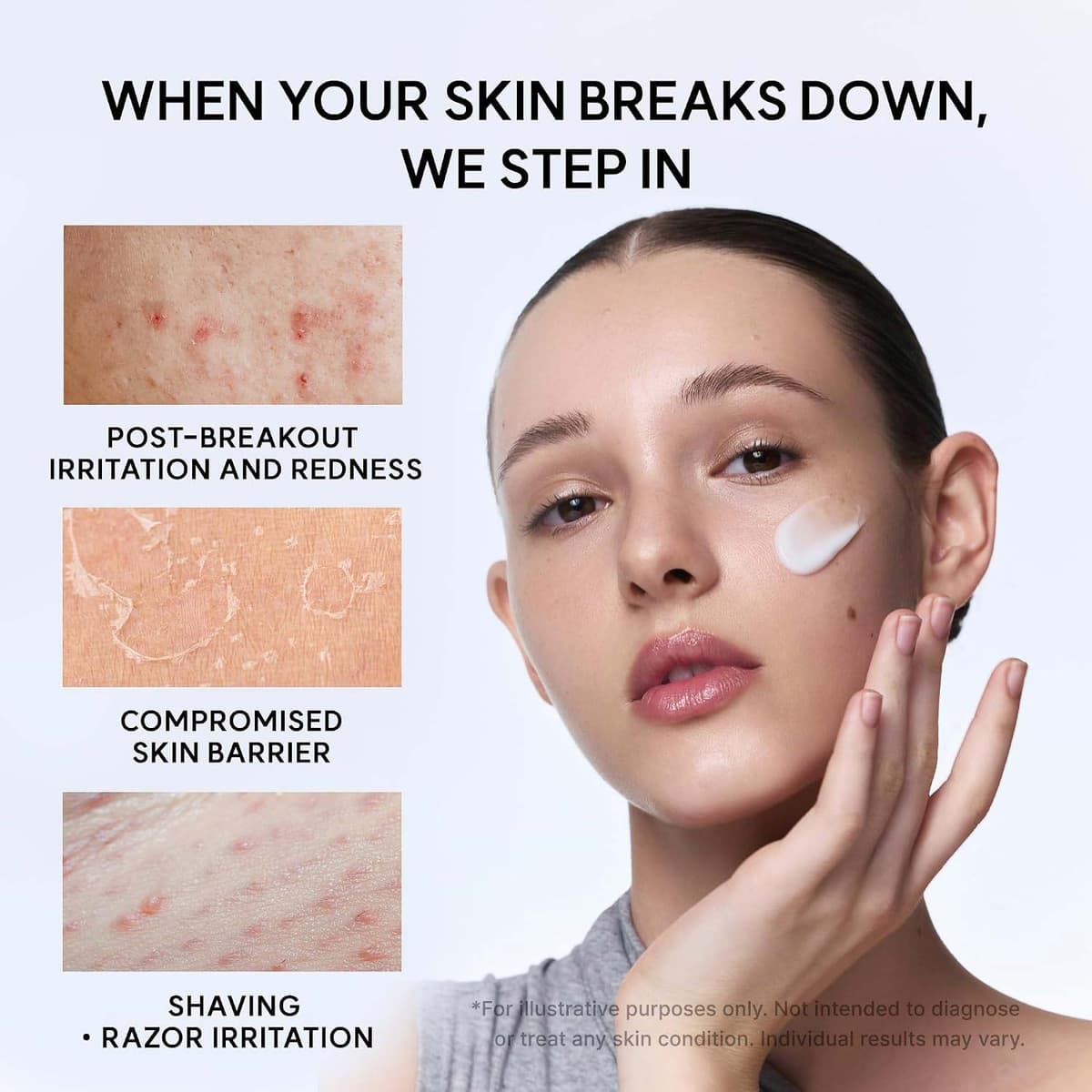 Arencia Eraser Soothing Facial Moisturizer Cream