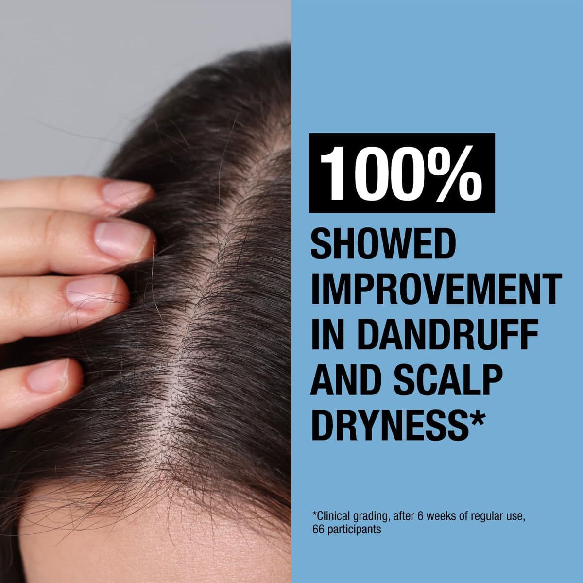 Neutrogena T/Gel Anti-Dandruff Scalp Relief Shampoo